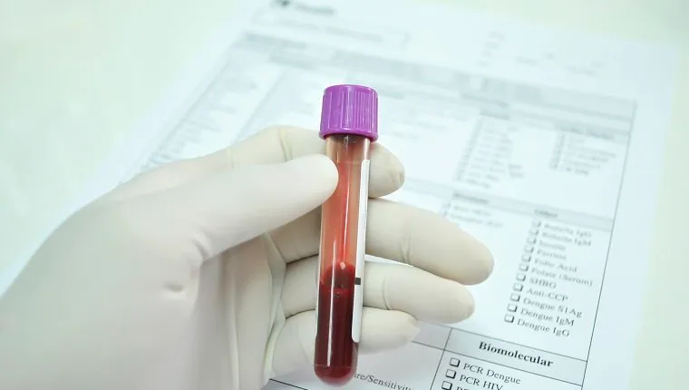 blood tube in hand of scientist